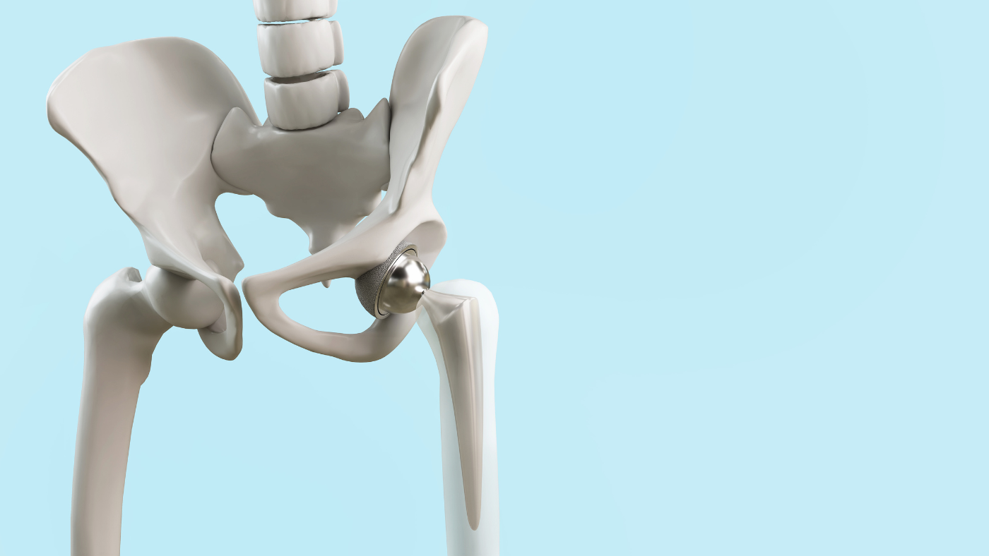 Dr Oliver Khoo – Sydney’s Premier Hip Replacement Specialist