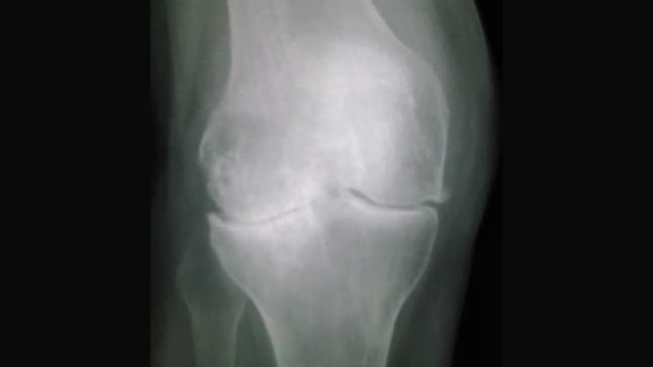 Top Hip Replacement Surgeon in Sydney: Dr Oliver Khoo